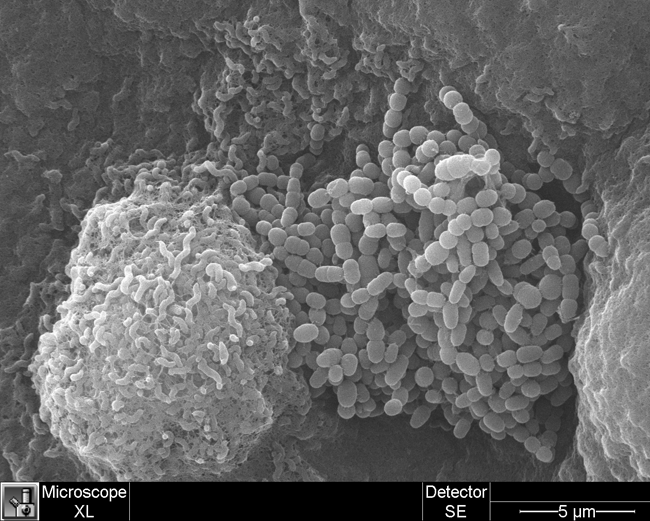 electron microscope images