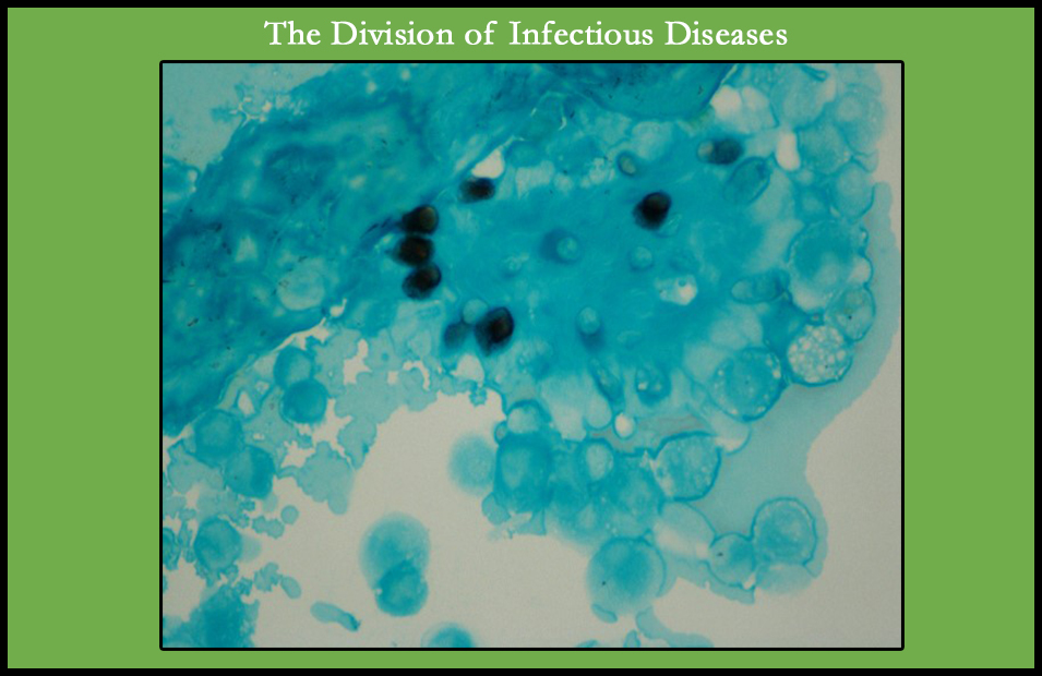 Division Of Infectious Diseases | Department Of Medicine