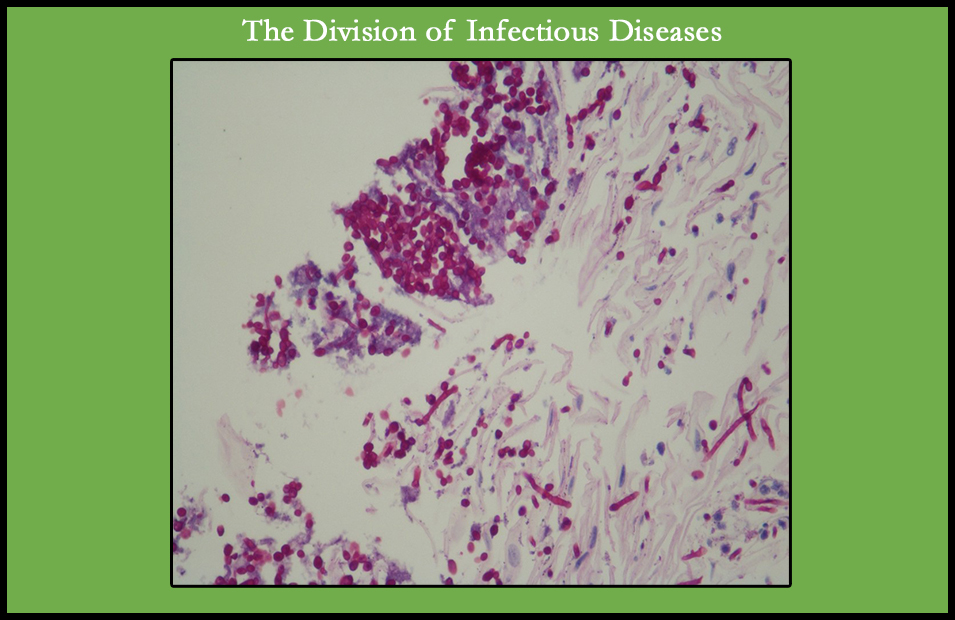 Division Of Infectious Diseases | Department Of Medicine