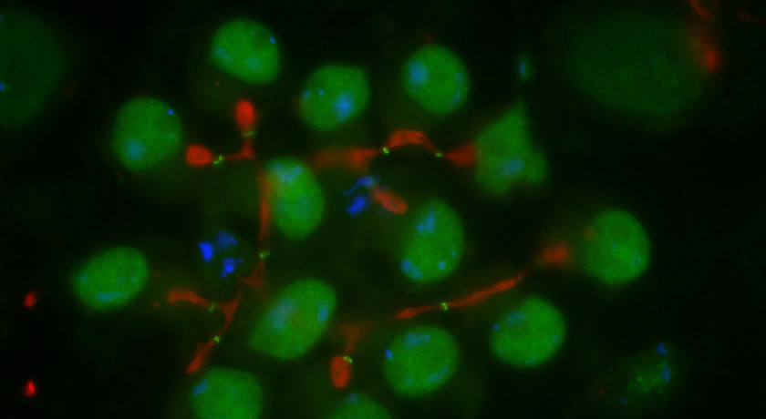 New cell cycle regulatory mechanism discovered in a study of Drosophila male meiosis