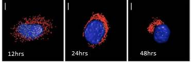 Localization of +vRNAs