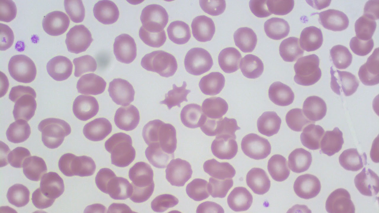 oer-digitized-hematology.png