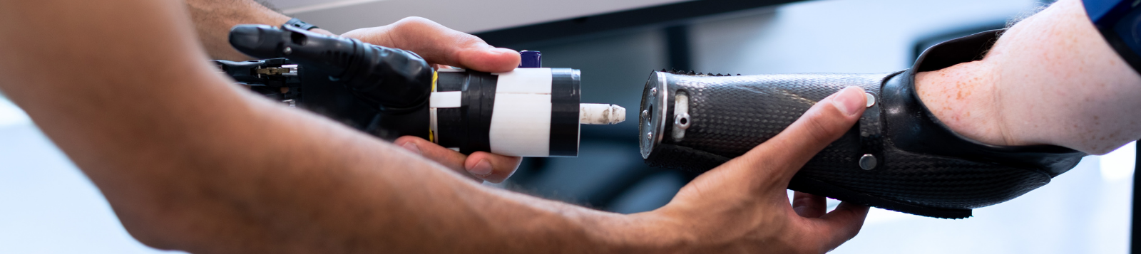 Picture of a person getting fitted for an arm prosthetic