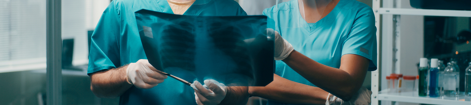 Picture of two physicians looking at an xray of lungs