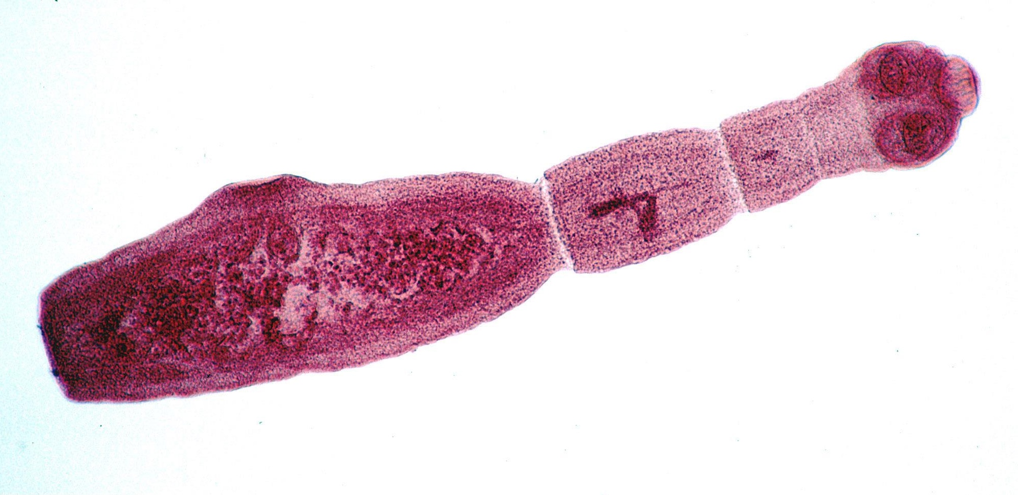 210617-tapeworm-echinococcus-multilocularis-adult-main.jpg