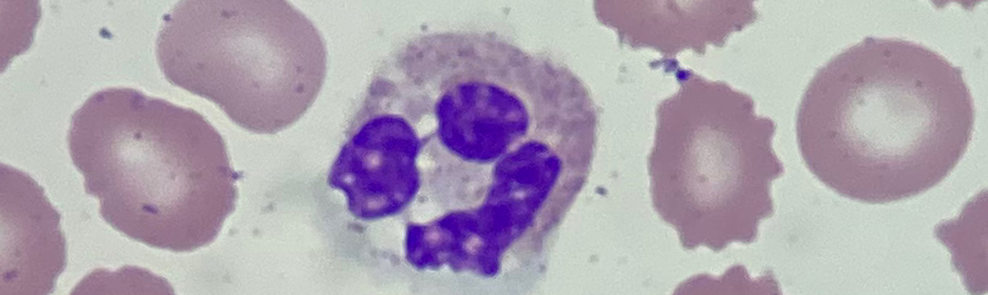 hemepath_neutrophil-2010x600.jpg