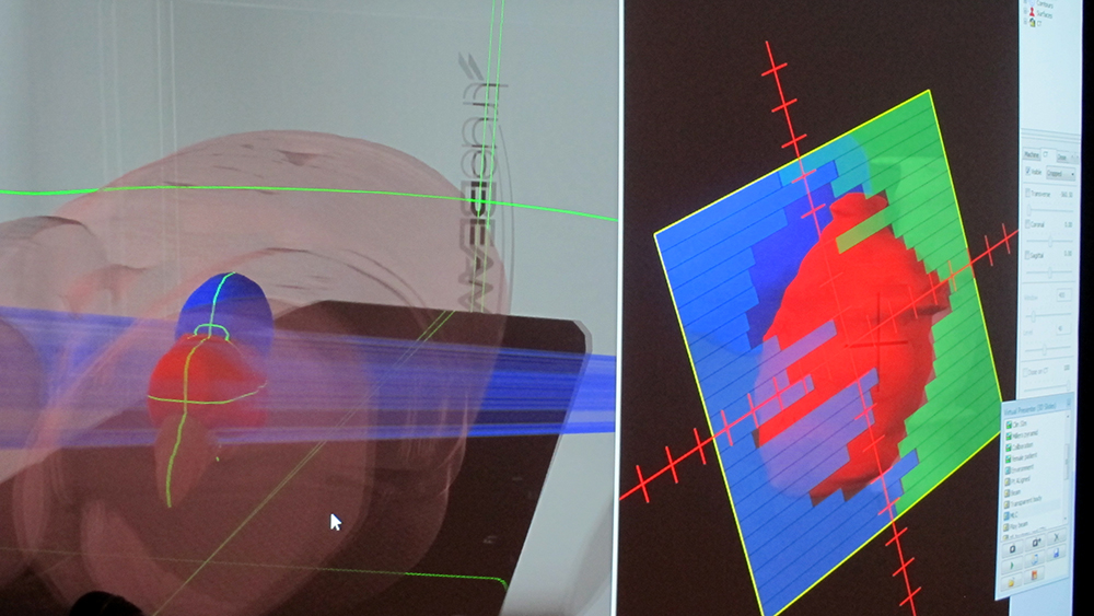 Images of targeted treatment delivered by VERT