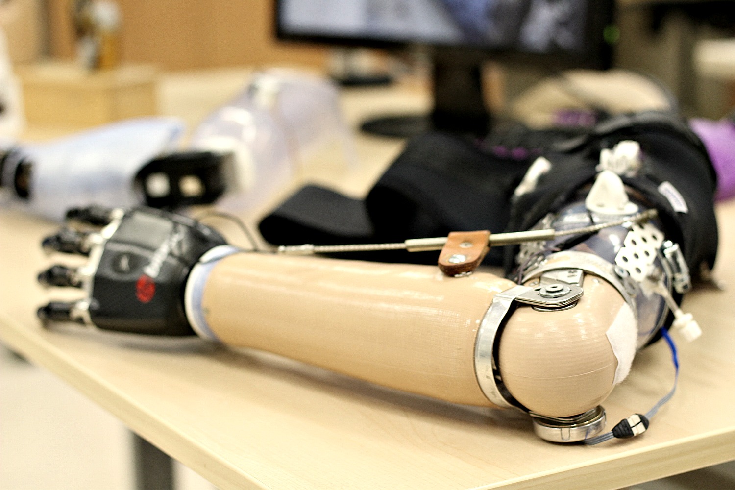 Prosthetic arm