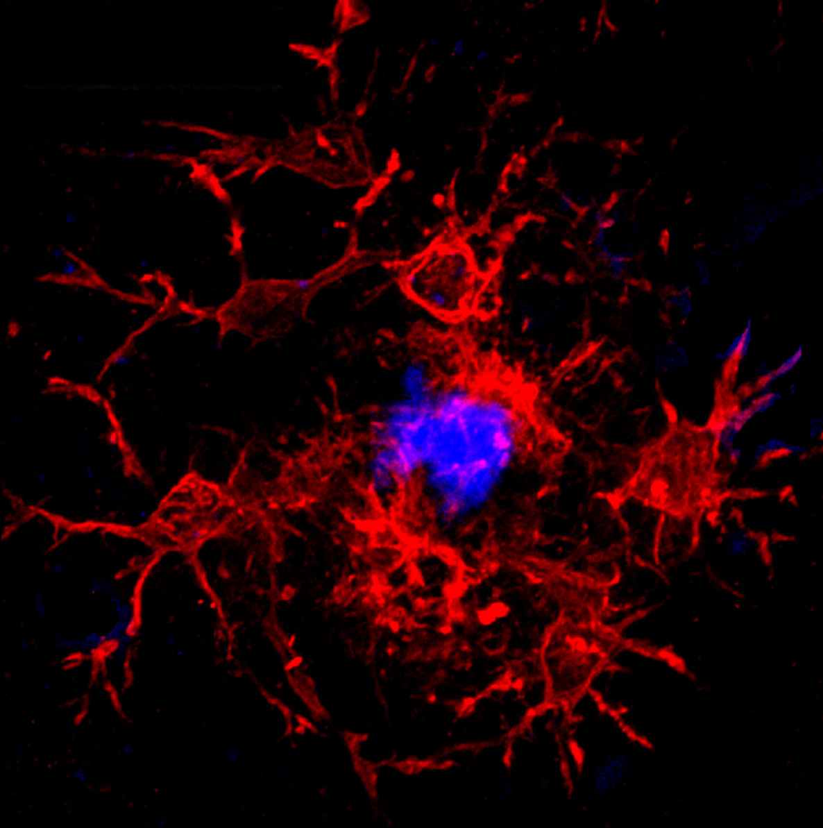 photo of microglia