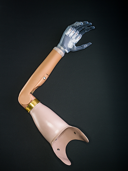 Bionic arm