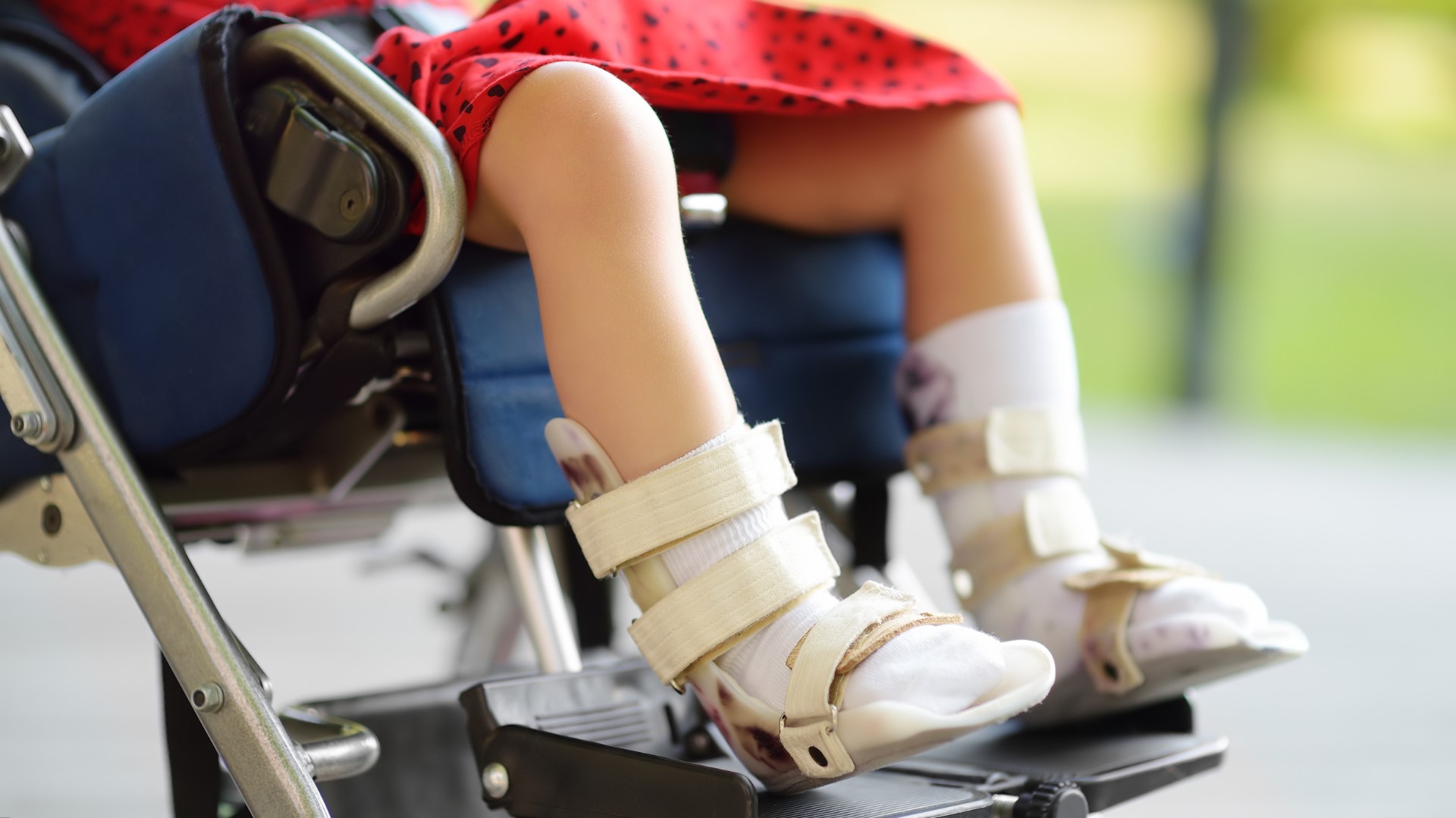 Image of legs of child in a wheelchair